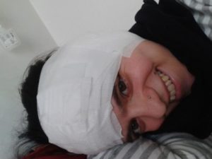 Das Bild zeigt Sabrina nach der ersten CI Operation mit Druckverband auf einem Bett liegend.